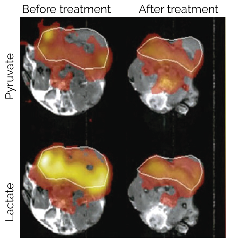DNP MRI